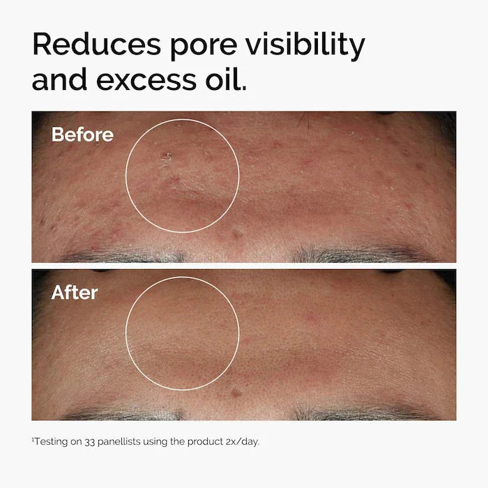 Niacinamide 10% + Zinc 1% - sérum anti-imperfection